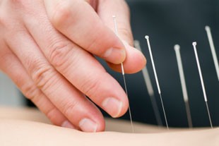 Acupuncture For Back Pains